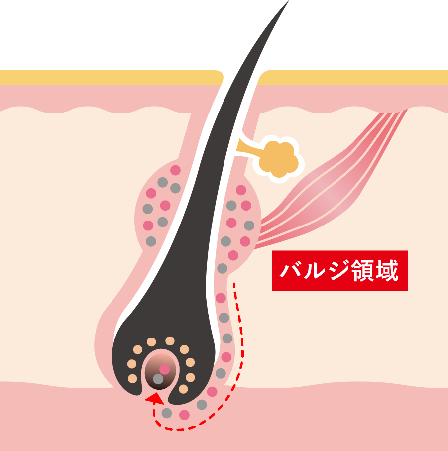 色素幹細胞が枯渇すると白髪になる !